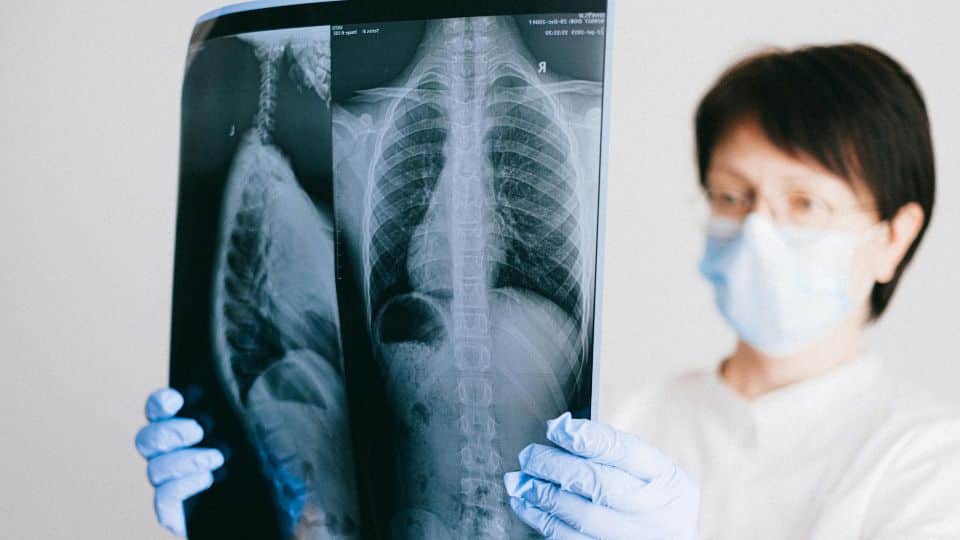 Hidden Dangers of Asbestos